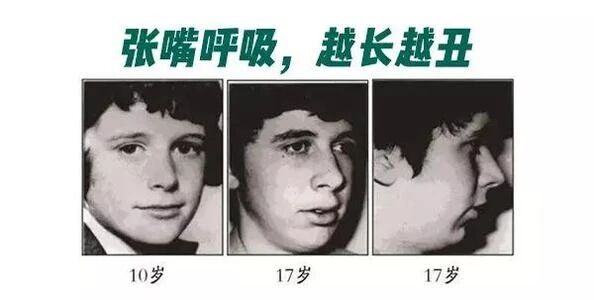 用嘴呼吸很伤牙！一个视频记录牙齿变“歪”全过程