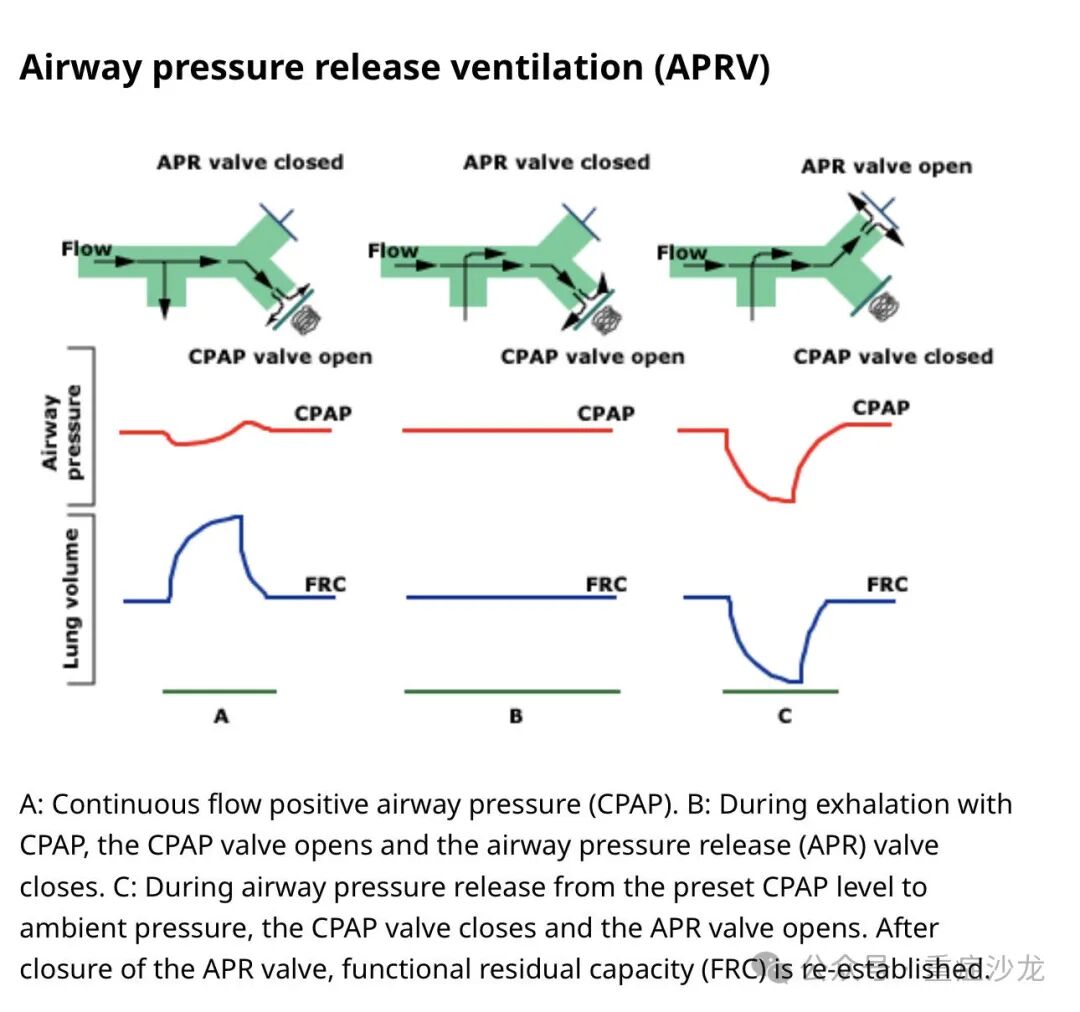 什么是 bipap机械通气基础教程（三）_https://www.jmylbn.com_新闻资讯_第1张