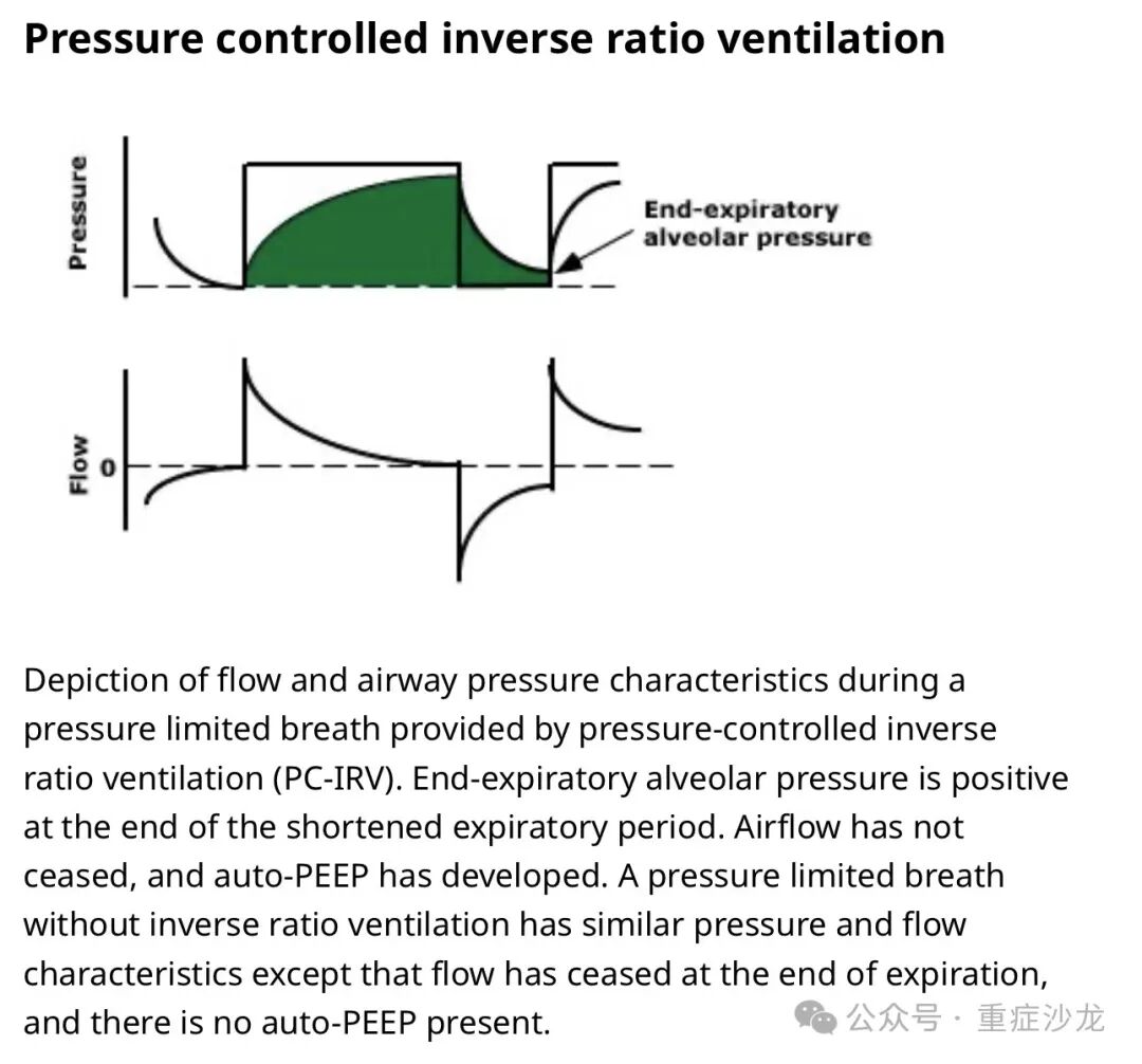 什么是 bipap机械通气基础教程（三）_https://www.jmylbn.com_新闻资讯_第4张