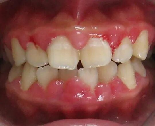 什么是口腔修复膜【名医名科】口腔中心帮您解决牙菌斑生物膜的困扰_https://www.jmylbn.com_新闻资讯_第6张