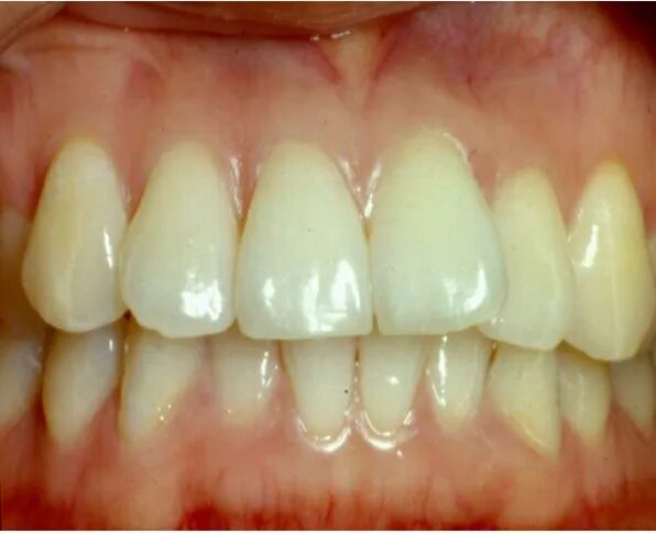 什么是口腔修复膜【名医名科】口腔中心帮您解决牙菌斑生物膜的困扰_https://www.jmylbn.com_新闻资讯_第5张