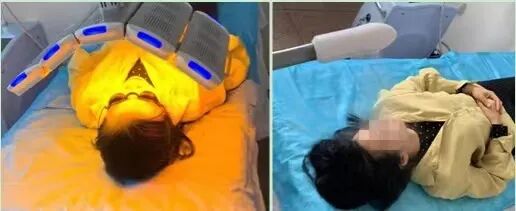冷红光治疗有什么作用【黄骅市医院医疗服务能力提升系列】红蓝黄光动力治疗仪 让您的皮肤更健康_https://www.jmylbn.com_新闻资讯_第5张