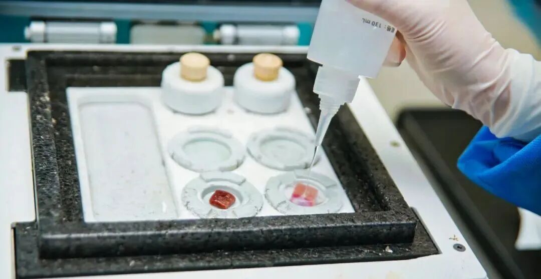 助力湖北&ldquo;數(shù)智化病&rdquo;培訓(xùn)項(xiàng)目，讓冰凍切片更輕松！