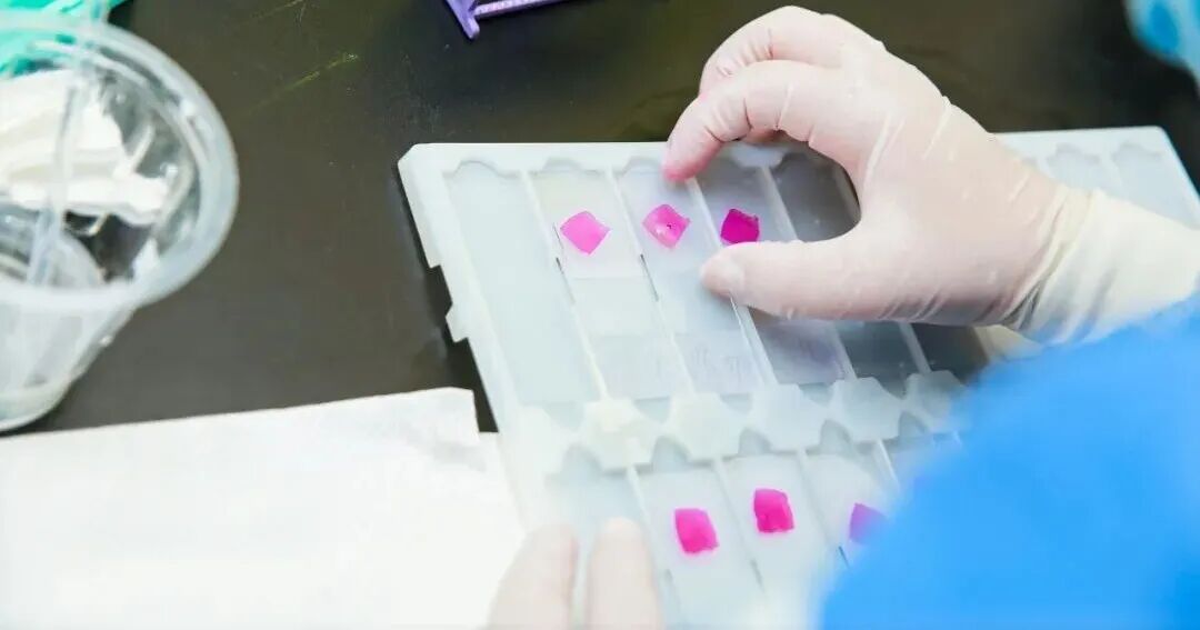 助力湖北&ldquo;數(shù)智化病&rdquo;培訓(xùn)項(xiàng)目，讓冰凍切片更輕松！