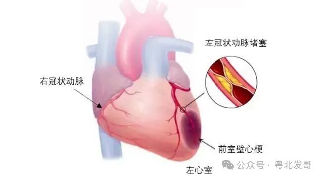 治病毒性心肌炎特效方