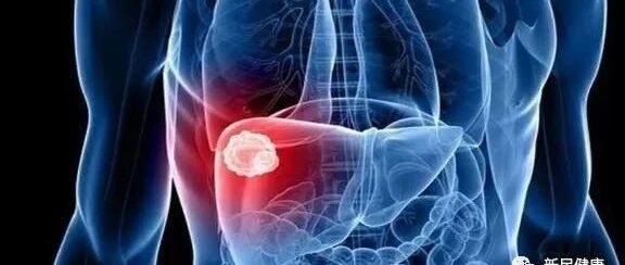 肝病“很怕”3种水，若你刚好爱喝，排清毒素，肝越来越好！【新民健康】