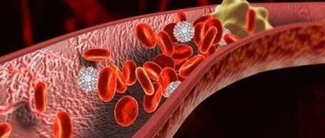 体内有血栓，身体往往有四个标志，做好这4点，血管或许更通畅【新民健康】