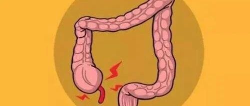 结直肠癌为何成为我国第4大癌？提醒：想长寿，牢记“三早”指南【新民健康】