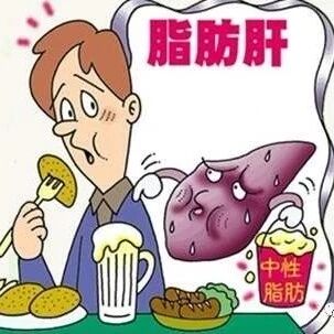 10大妙招，让脂肪肝不再“为所欲为”！【新民健康】