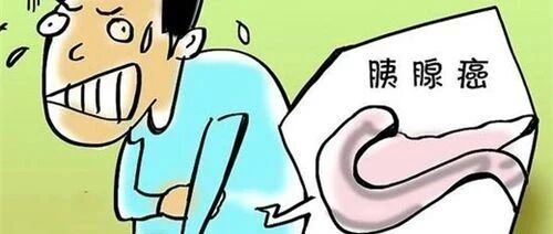 出现这4个现象的人，最招胰腺癌“喜欢”！【新民健康】