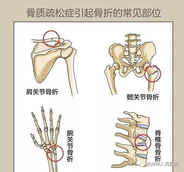 汝州市人民医院