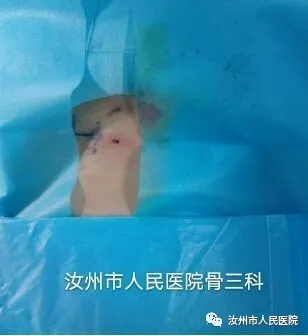 汝州市人民医院