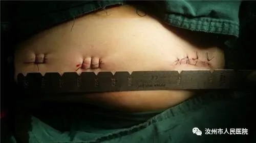 汝州市人民医院