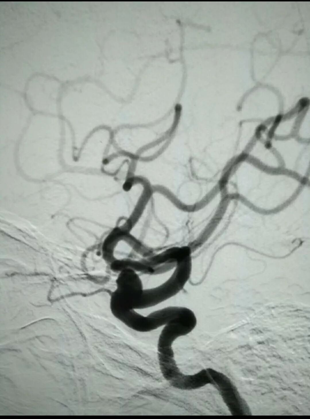 汝州市人民医院