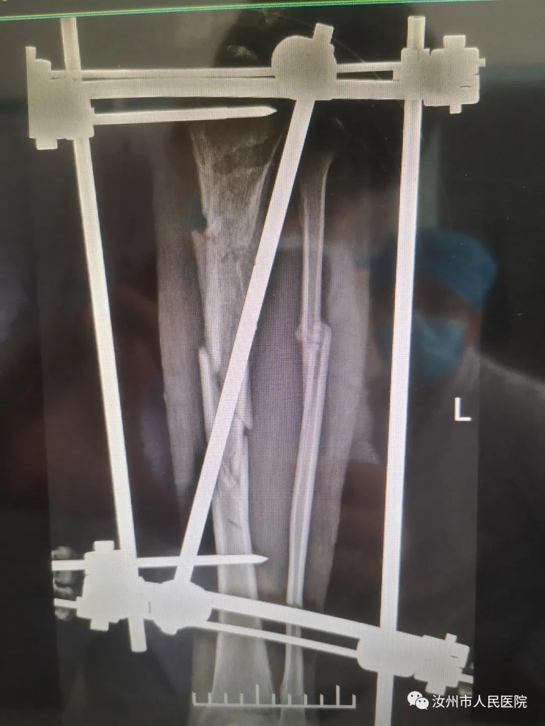 汝州市人民医院