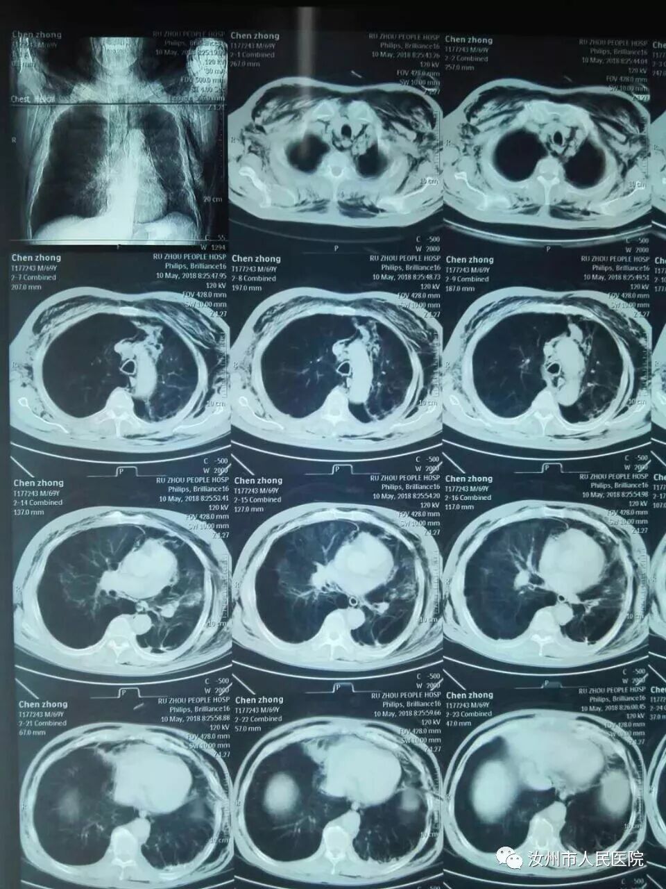 汝州市人民医院