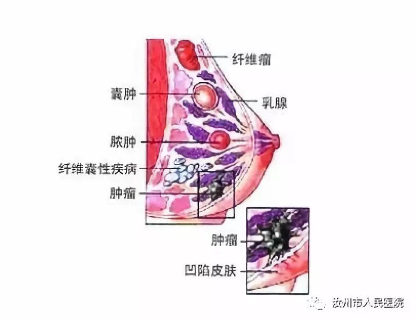 汝州市人民医院