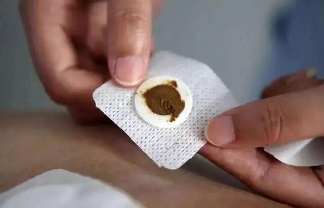什么材质贴敷中药贴敷知多少-上海聚慕医疗器械有限公司