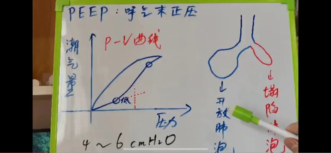 插管呼吸机有什么利弊气管插管如何选择呼吸机模式？3分钟快速入门！_https://www.jmylbn.com_新闻资讯_第7张