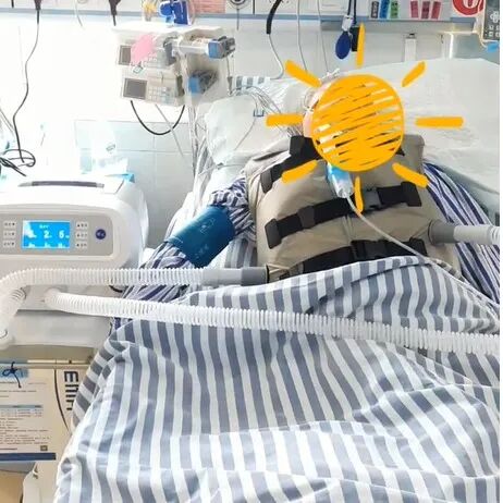 为什么要电动吸痰排痰小能手 守护患者健康——高频振动排痰仪_https://www.jmylbn.com_新闻资讯_第2张