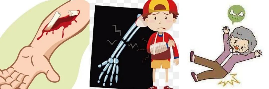 vsd引流怎么拔出VSD负压引流技术 让患者创面更快痊愈_https://www.jmylbn.com_新闻资讯_第10张