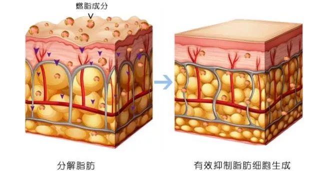 洗澡就能瘦身、減脂？健身2小時，不如用它洗澡20分鐘！ 健康 第5張