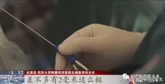取卵针长什么样论女性试管风险有多大，恰似那近半米长的取卵针_https://www.jmylbn.com_新闻资讯_第6张