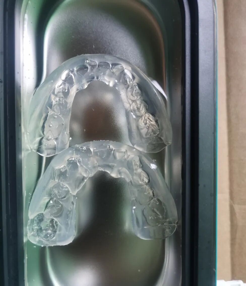 还有的是没规律的磨牙,一般不磨,突然有几天半夜就磨得咯吱咯吱响,就