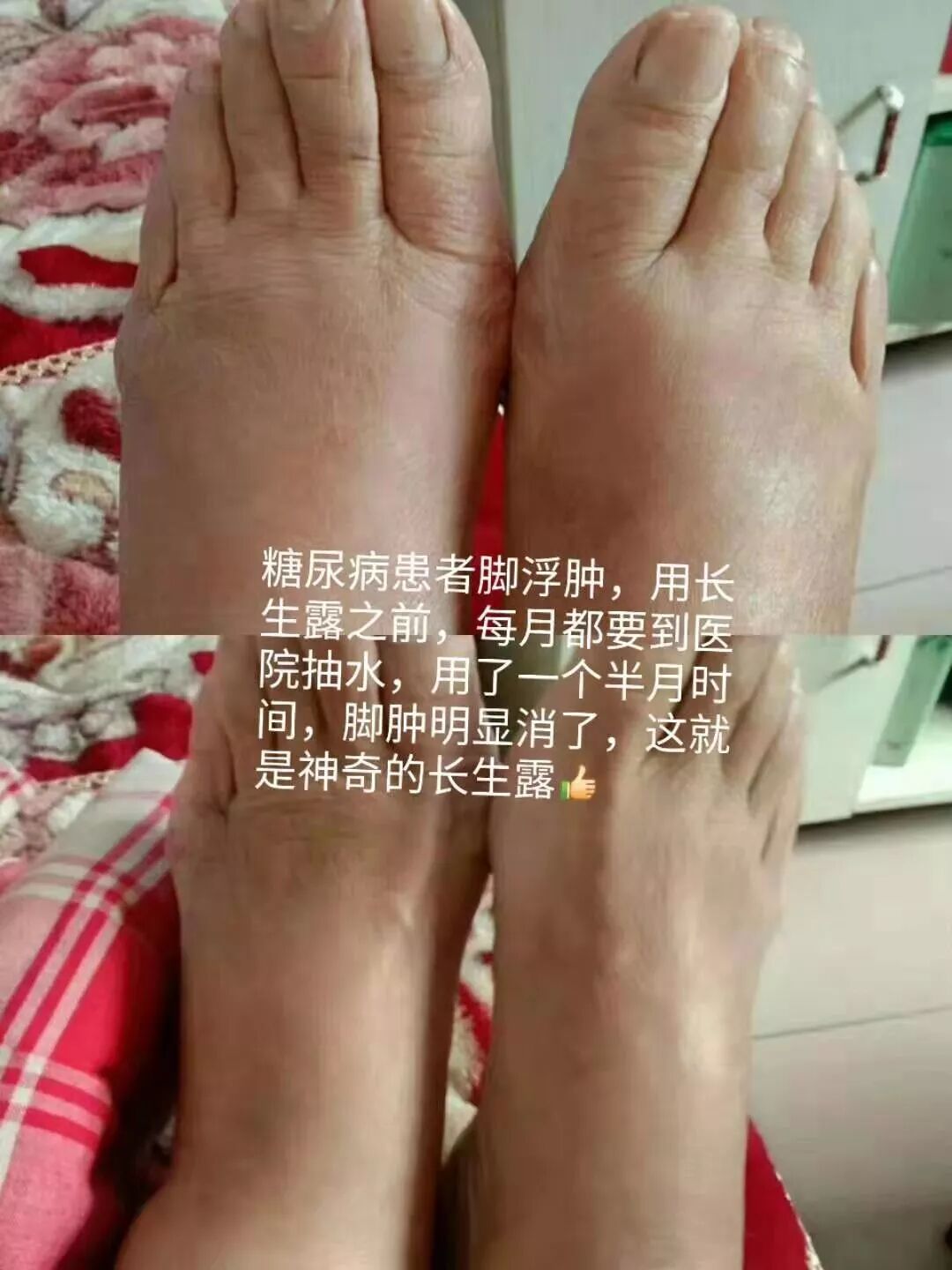 长生露的效果好不好?长生露 山药黄精复合饮品价格-中华在线