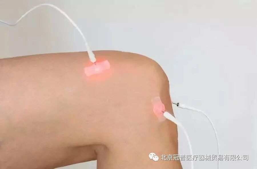 电热针灸怎么做同样是针灸发展的新形式，电热针相比其他针灸形式有哪些独特之处？_https://www.jmylbn.com_新闻资讯_第1张