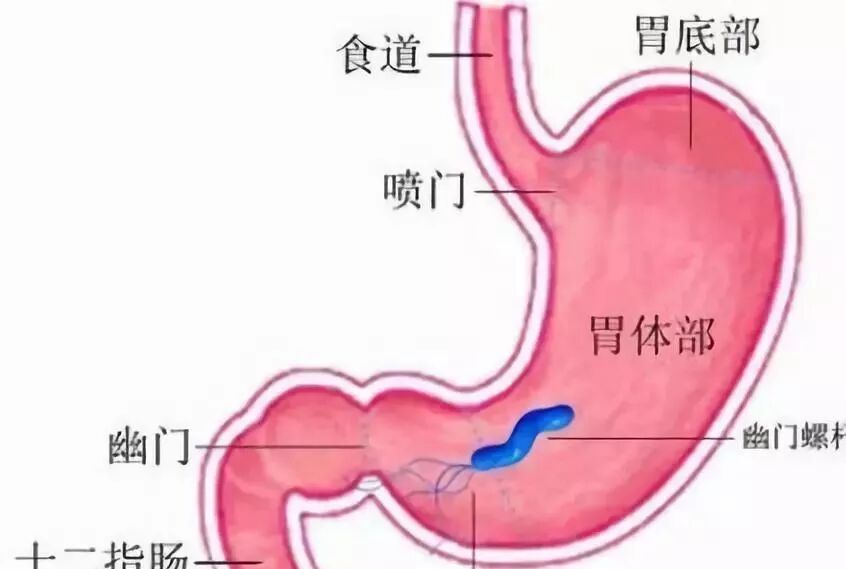 早期胃癌有迹可寻 三个小症状早已提醒您 很多人却忽视了 健康生活啦 微信公众号文章阅读 Wemp