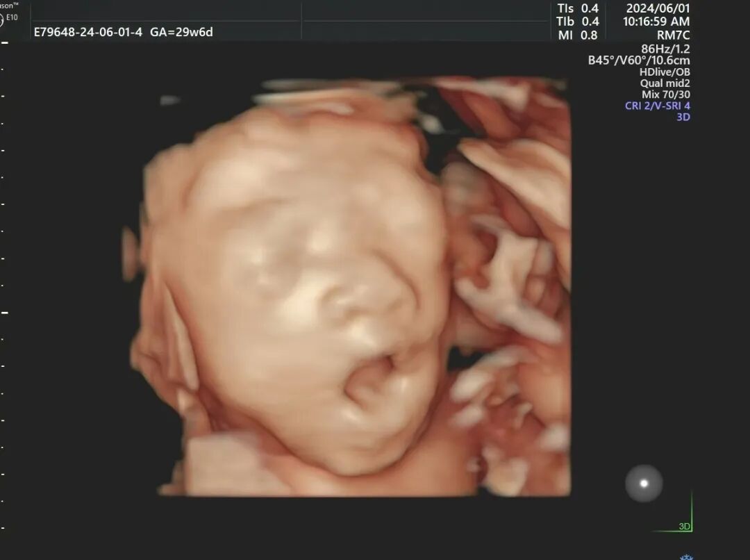 汕头彩超怎么样胎儿在肚子里可一点不无聊~不信咱们四维见！_https://www.jmylbn.com_新闻资讯_第8张