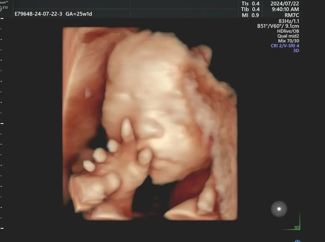 汕头彩超怎么样胎儿在肚子里可一点不无聊~不信咱们四维见！_https://www.jmylbn.com_新闻资讯_第6张