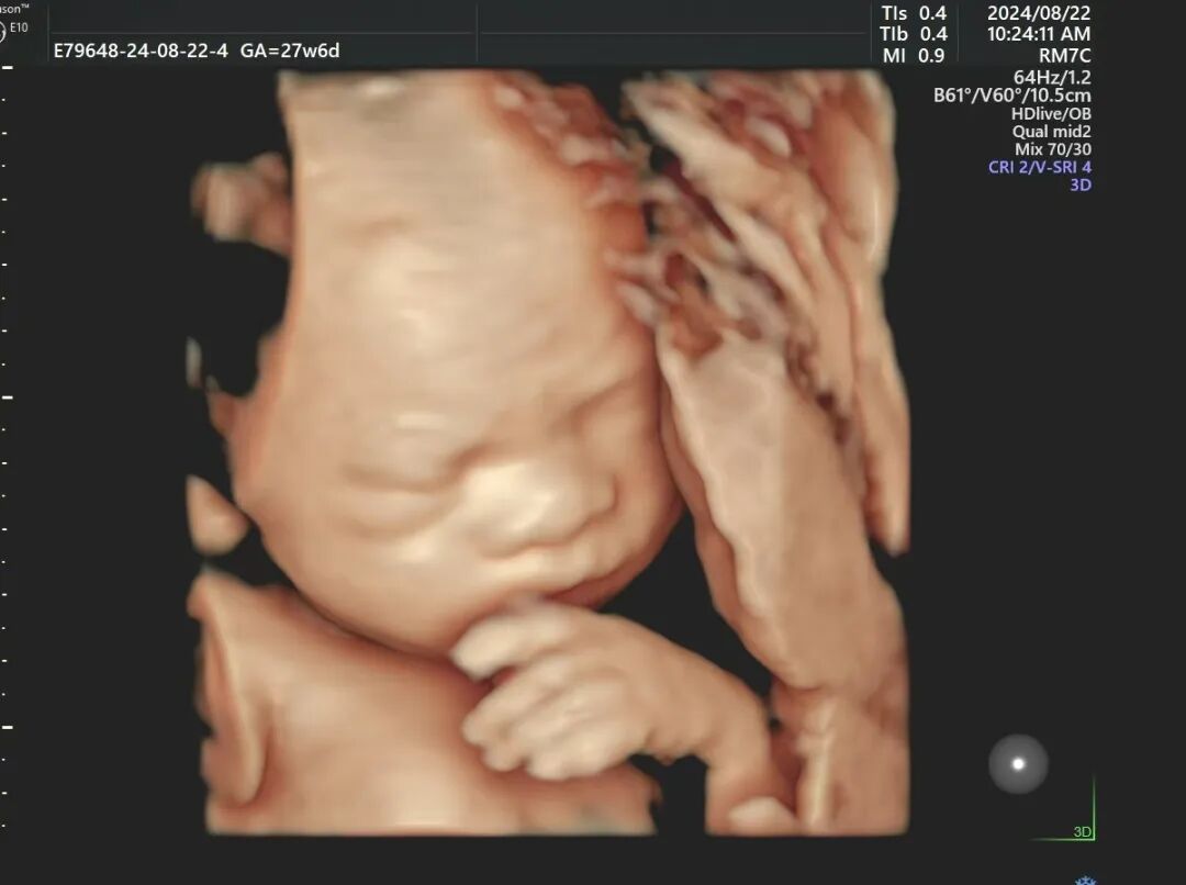 汕头彩超怎么样胎儿在肚子里可一点不无聊~不信咱们四维见！_https://www.jmylbn.com_新闻资讯_第7张