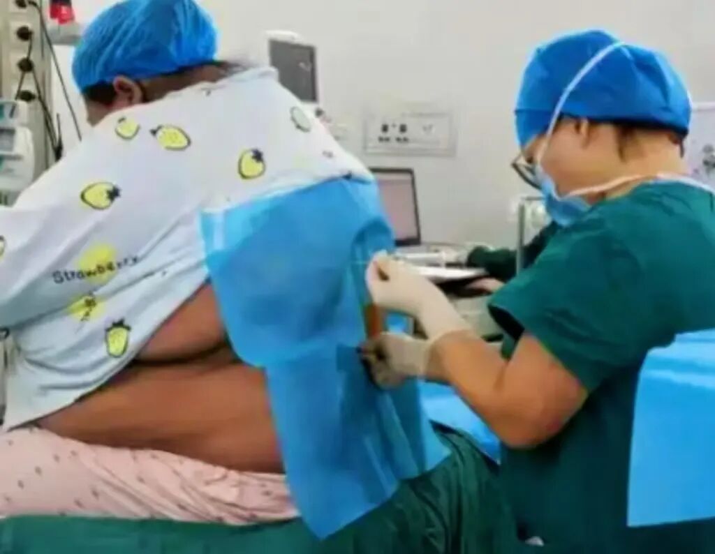 妇科手术床怎么座盘点妇产科手术需要“凹”的造型、“摆”的pose_https://www.jmylbn.com_新闻资讯_第6张