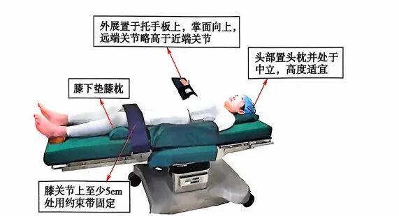 妇科手术床怎么座盘点妇产科手术需要“凹”的造型、“摆”的pose_https://www.jmylbn.com_新闻资讯_第2张
