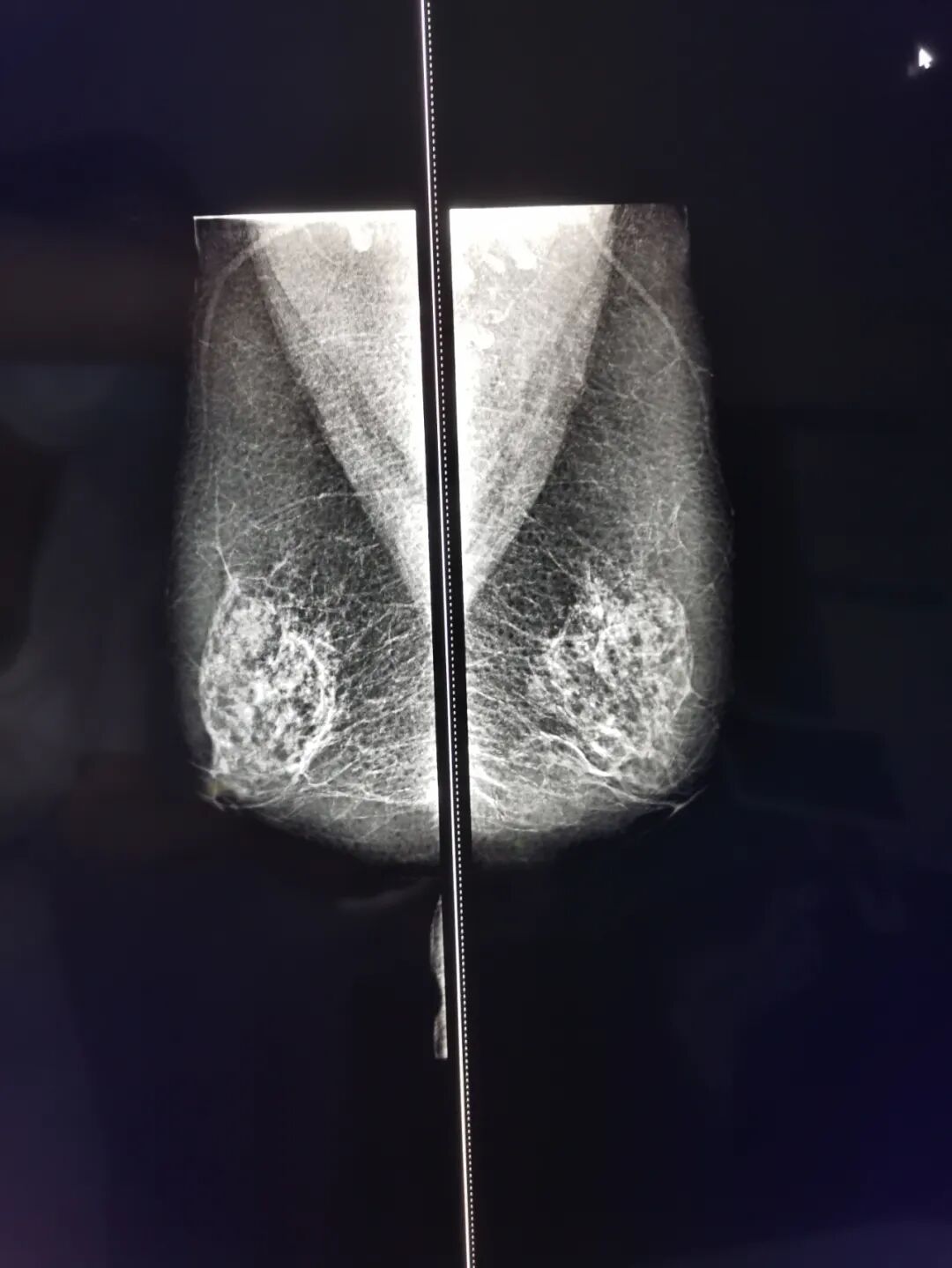 dr机什么意思【医疗发展】我院放射科新设备乳腺钼靶X线机和数字化摄影（DR）正式运营，有的“放”矢，做百姓健康的“侦察兵”！_https://www.jmylbn.com_新闻资讯_第5张