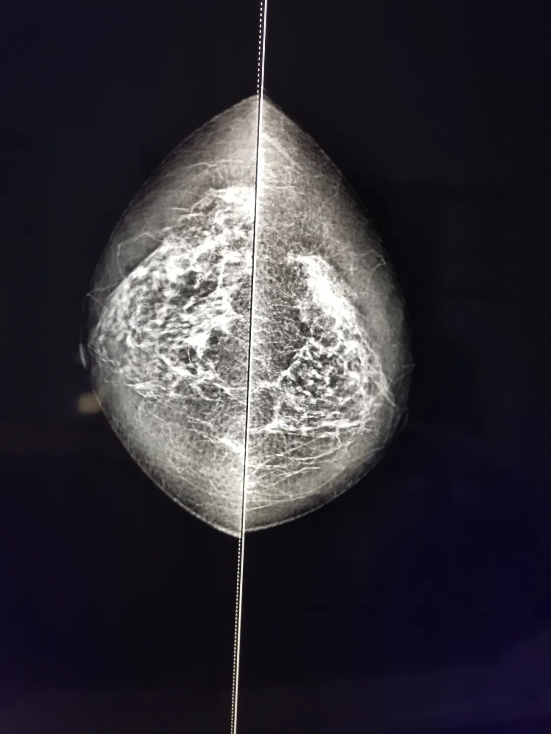 dr机什么意思【医疗发展】我院放射科新设备乳腺钼靶X线机和数字化摄影（DR）正式运营，有的“放”矢，做百姓健康的“侦察兵”！_https://www.jmylbn.com_新闻资讯_第3张