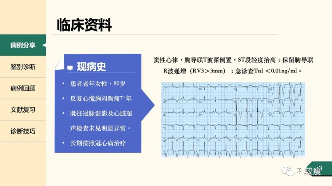 T波深倒置的鉴别诊断：从心电图到超声