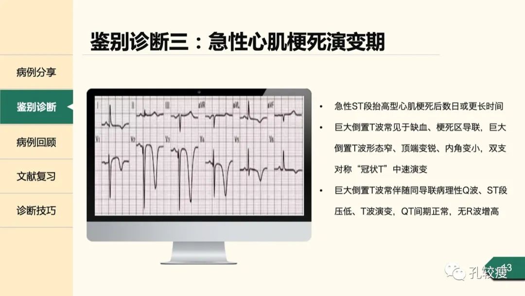 T波深倒置的鉴别诊断：从心电图到超声