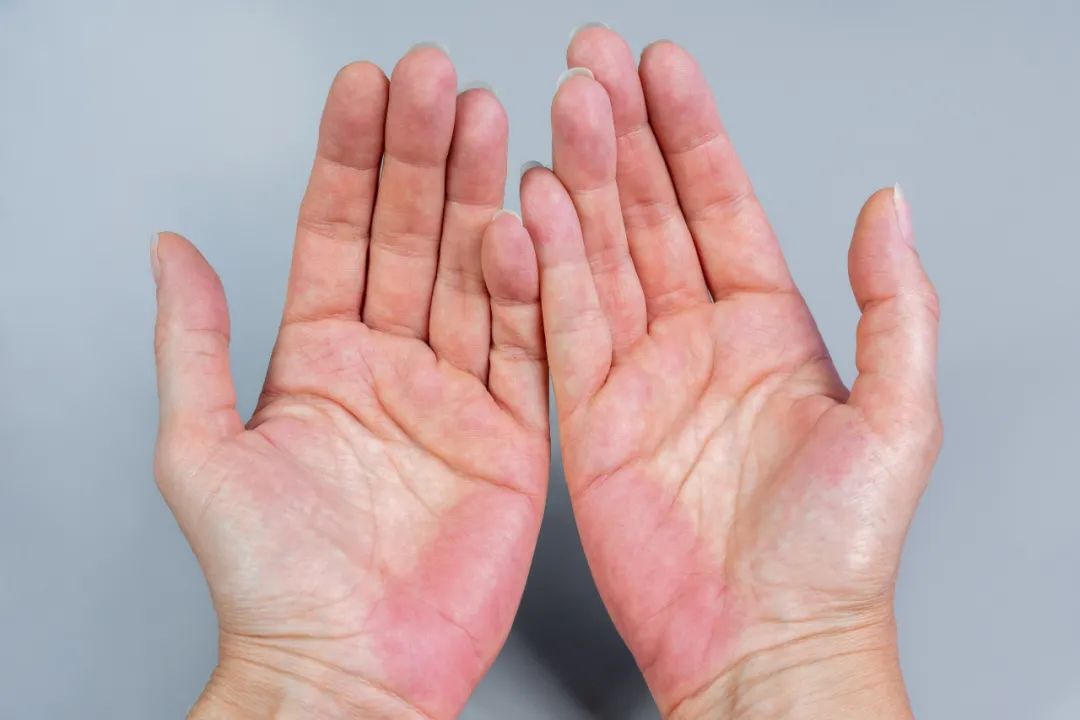 汤臣倍健,原以为只是手变丑,一查却是肺癌?