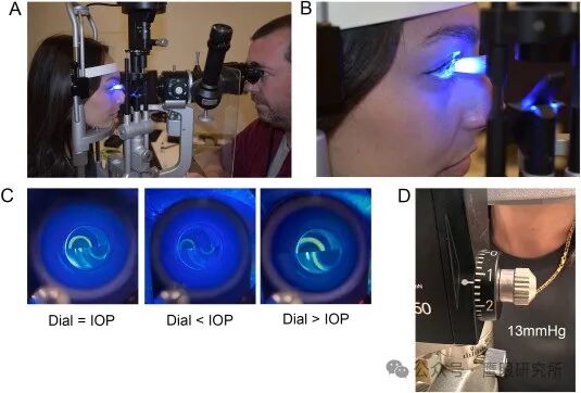 什么是回弹式眼压眼压与青光眼的关系：迄今为止最全面的眼压文献_https://www.jmylbn.com_新闻资讯_第7张