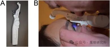 什么是回弹式眼压眼压与青光眼的关系：迄今为止最全面的眼压文献_https://www.jmylbn.com_新闻资讯_第8张