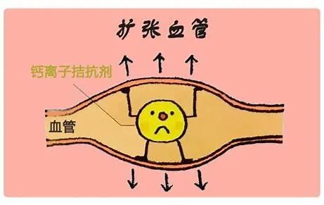 ccb类药物通过阻断血管平滑肌细胞上的钙离子通道导致血管扩张,达到