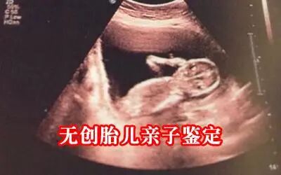 上海亲子鉴定在哪里做,费用是多少？