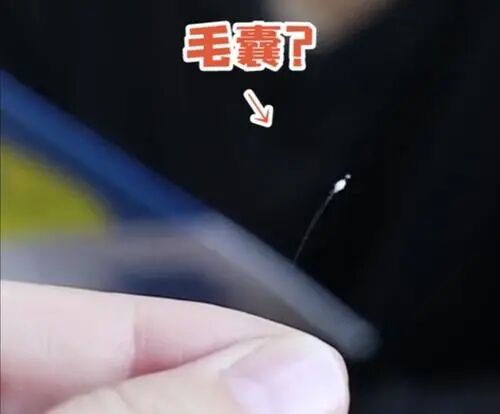 用头发做亲子鉴定多少钱?看着里!