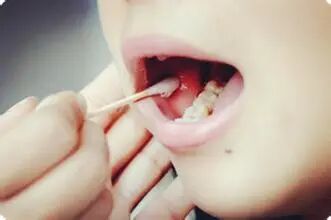 亲子鉴定需要一些什么样本？看着里！