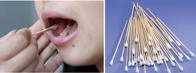 做亲子鉴定需要什么？