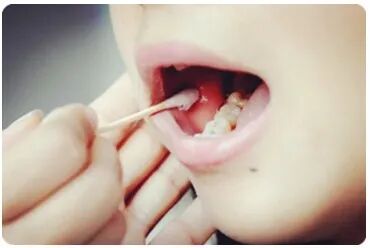 做一次亲子鉴定需要什么样本，看着里！