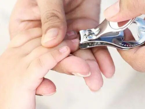 大人小孩指甲能做親子鑒定嗎?